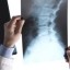 В крупных больницах Прикамья до конца года появятся мобильные рентгеновские аппараты